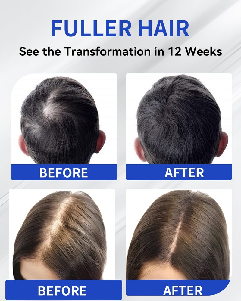Hair Growth Serum Roll On 1.76 fl oz | Extra Large Value Pack | Fast-Absorbing, No-Rinse Scalp Care | Rosemary, Caffeine, Niacinamide & Biotin | Mother’s Day Gift for Her
