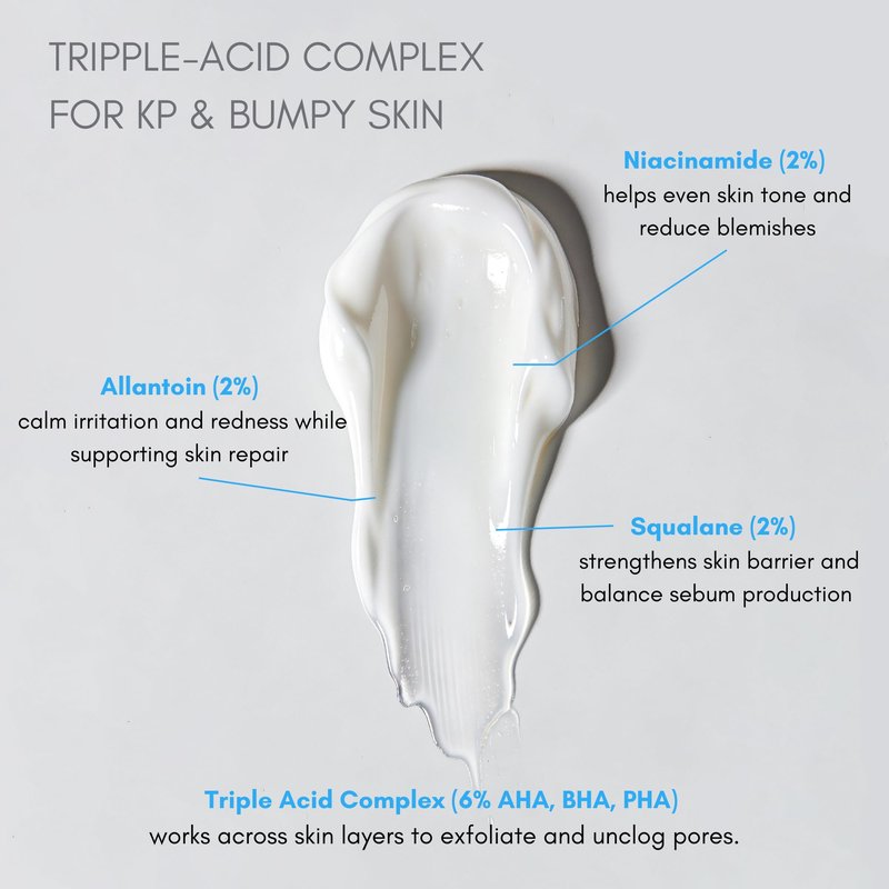 klarifyScience KP Treatment Serum - Triple Acid Complex (AHA + BHA + PHA) for Keratosis Pilaris | Gentle Daily Face and Body Serum for Rough Bumpy Skin, Strawberry Legs & Ingrown Hairs | 4 fl oz