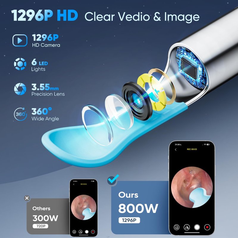 MOOPHY Ear Wax Removal Tool with Camera, 1296P HD Ear Cleaner with 6 LED Lights, Wireless Otoscope Earwax Removal Kit with Silicone Tips & Ear Spoons, Ear Camera for iPhone, iPad & Android, White