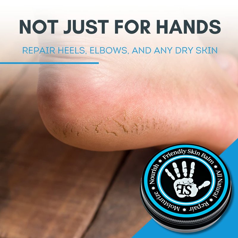 Organic Friendly Skin Balm - Organic Rock Climbing and CrossFit Hand Care for Athletes - Skin Friendly Moisturizing and Repair for Hands, Feet, Elbows and Lips