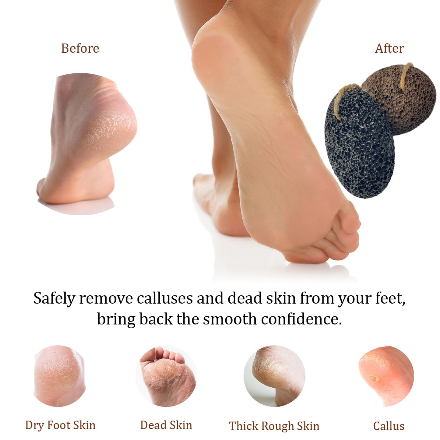 Pumice Stones for Feet - Natural Black Brown Earth Lava Stones Pack of 2 - Callus Corn Remover for Feet Heels and Palm - Pedicure Exfoliation Tool - Dry Dead Skin Scrubber - Health Foot Care