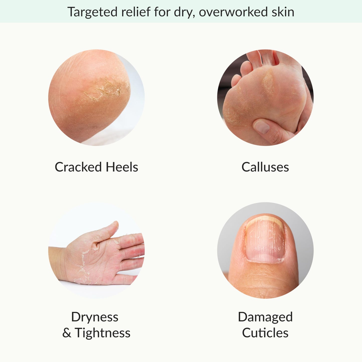 Epielle Relaxing & Nourishing Hand & Foot Masks, Soften Dry, Overworked Skin, Self Care Gifts for Women, Spa Kit, 6 Moisturizing Gloves & 6 Moisturizing Socks