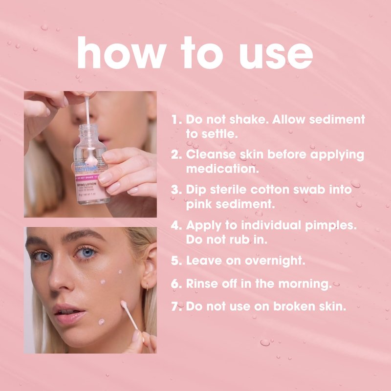 Bye Bye Blemish Drying Lotions, Spot Treatments