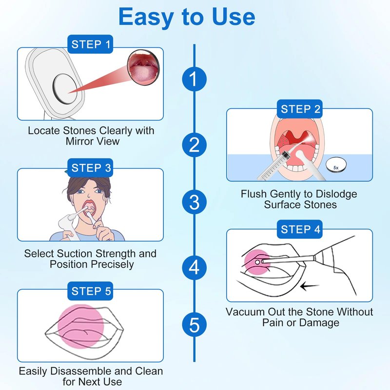 Tonsil Stone Remover Tool, Upgraded Electric Tonsil Stone Removal Kit - with Built-in LED Light & 6-Level Suction for Bad Breath Prevention, Oral Suction Device for Stone Removal
