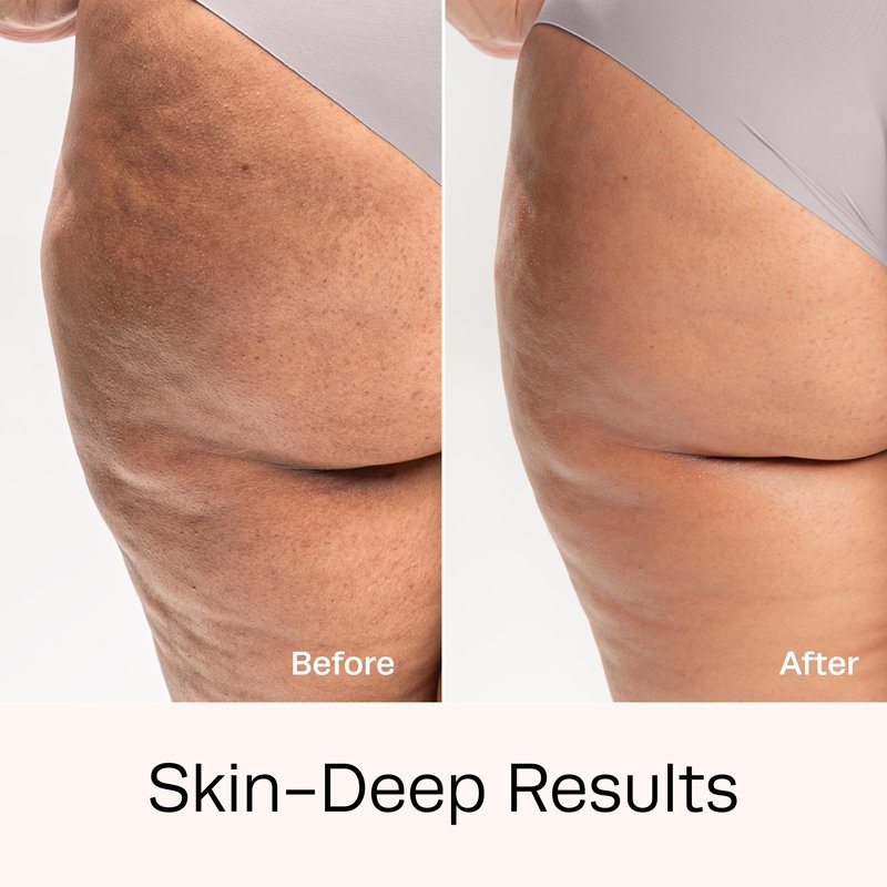 Hot Vita Retinol Toner – Roll-On Oil with Retinol for Smoother, Firmer-Looking Skin – Targeted Care for Belly, Thighs, Arms & Legs – Helps Improve Texture and Appearance