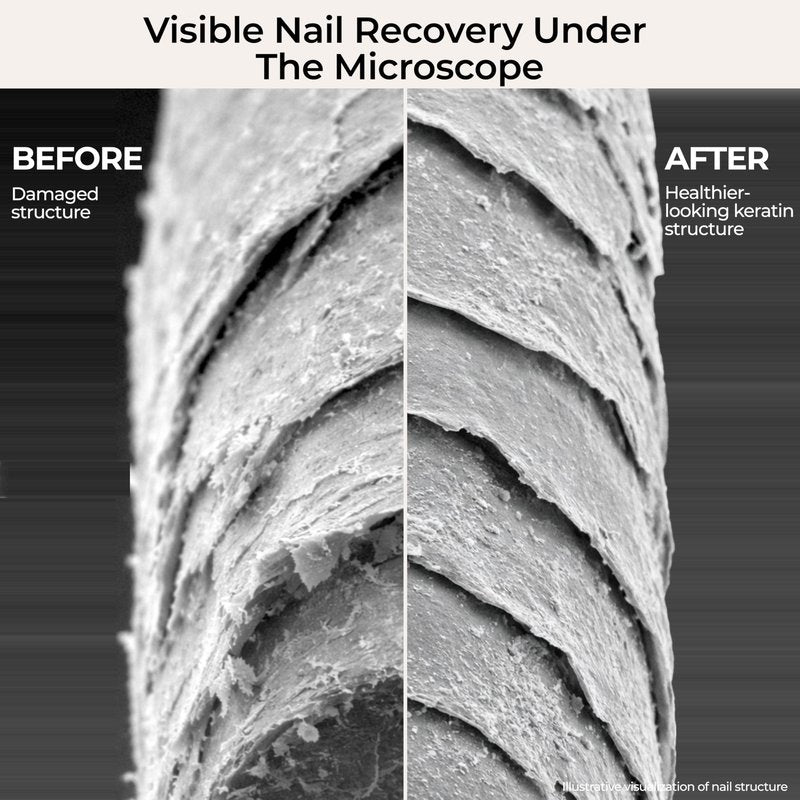 Fast Absorbing Nail Strengthening Serum for Damaged, Brittle & Thin Nails — Post-Acrylic & Gel Damage Treatment with Keratin, Peptides, Hyaluronic Acid & Niacinamide — 45-Day Supply by nakeyNails