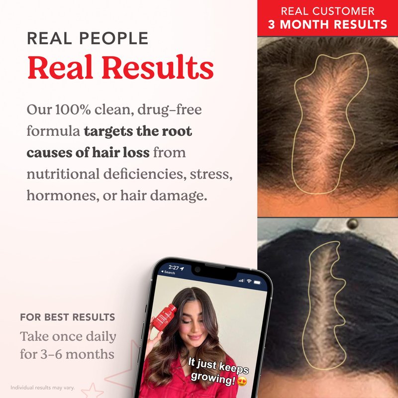HAIRtamin Advanced Formula Hair Growth Supplement for Women & Men, Supports Stronger, Longer, Visibly Thicker Hair, With 5000 mcg Biotin, Vitamins & Antioxidants, 100% Vegan – 1 Month Supply