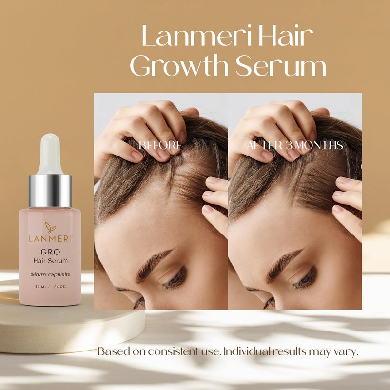 Lanmeri Vegan Hair Growth Serum - Natural Hair Regrowth and Hair Loss Treatments for Women & Men - Scalp Serum for Thinning Hair - Fuller, Thicker and Healthier Hair in 90 Days, All Hair Types