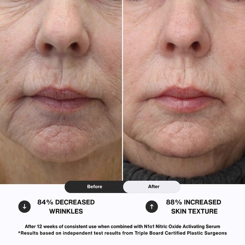 N1O1 Moisturizer Face Cream - Day & Night Face Moisturizer with Nitric Oxide, Peptide Complex, Epidermal Growth Factor - Tightening & Firming Skin Care Products for Wrinkles, Dark Spots - 1.75 oz.