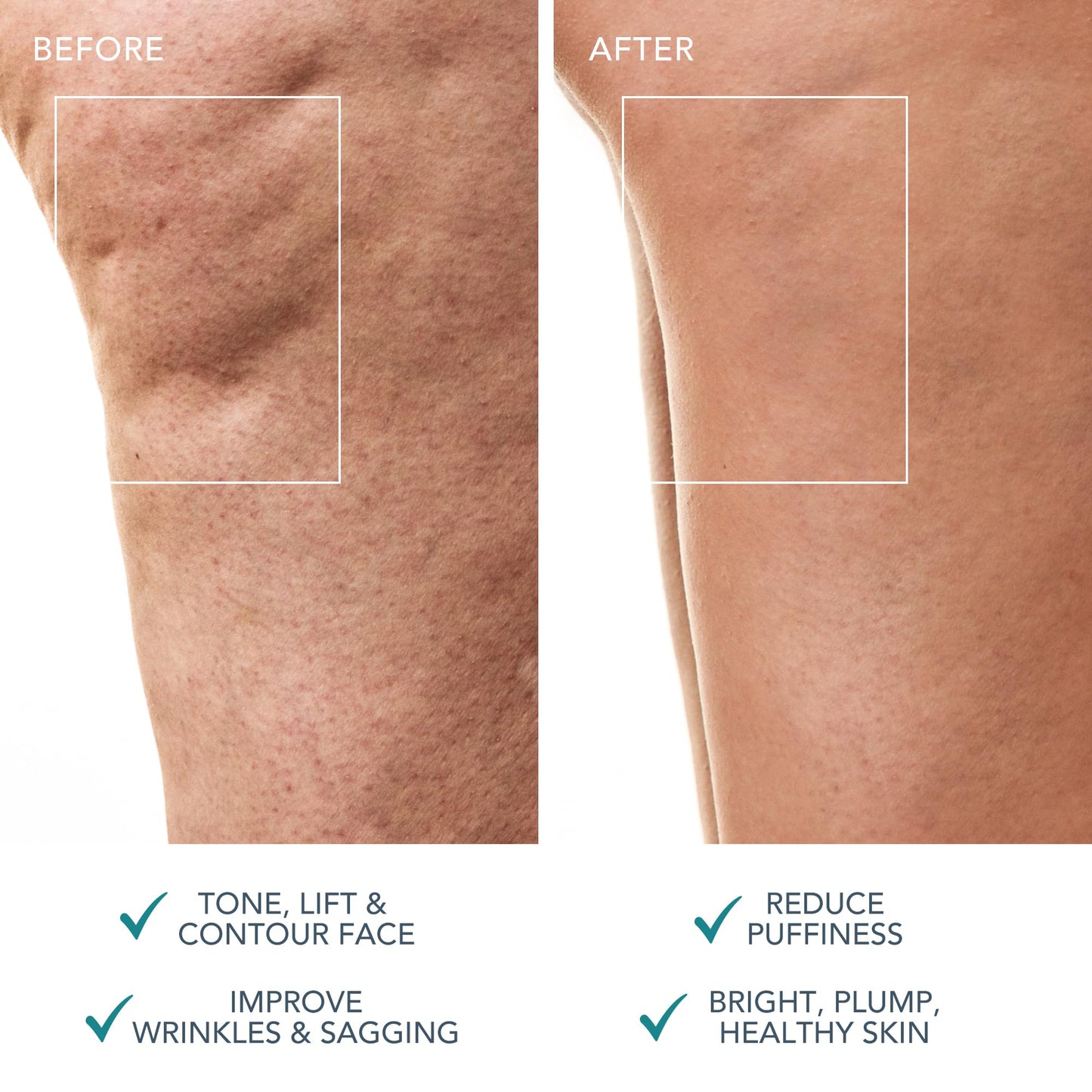 FOREO BEAR 2 body Advanced Microcurrent Body Sculpting Machine - Cellulite Massager & Lymphatic Drainage - Firm & Contour - Body Massager - Increases Absorption of Skin Care Products - Evergreen