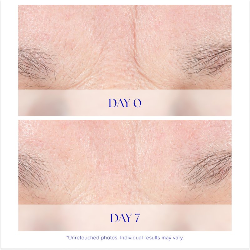 iS CLINICAL Youth Intensive Crème. Anti-aging, firming face cream. Reduces appearance of fine fines and wrinkles