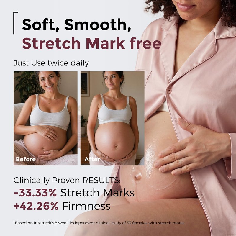 Momcozy Stretch Mark Cream, EWG Verified & Dermatologist Tested, 4x Peptide & Centella Oil Capsule Belly Moisturizer for Pregnancy, Nourishes Dry Skin, 5.29 oz (150g)