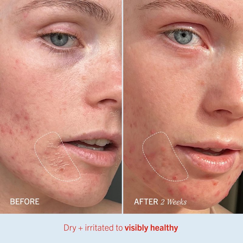 First Aid Beauty Ultra Repair Cream – Multi-Pack Options
