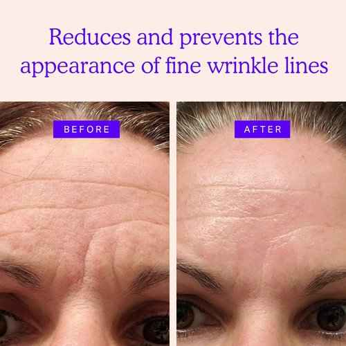 BLUMBODY Face Wrinkle Patch Complete Set, Chest Wrinkle Pad and Neck Wrinkle Pads Set Bundle