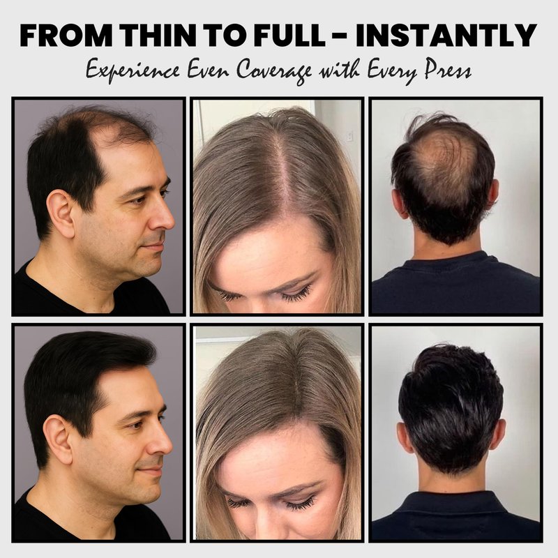 Adglamful 2PCS Hair Fibers for Thinning Hair, Hair Building Fibers Spray with Spray Applicator, Undetectable & Long-lasting, Instant Hair Coverage for Men & Women (Black, 30g*2)