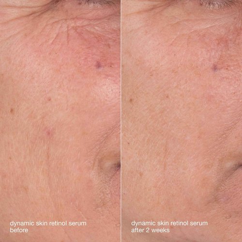 Dermalogica Skin Aging Solutions Kit, Anti Aging Skincare Set - Includes: Face Cleanser, Serum, Moisturizer with SPF, and Cream, Travel Size