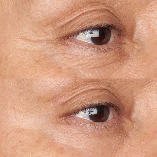 Perricone MD Hypoallergenic Clean Correction Firming & Brightening Eye Cream, 0.5 fl. oz.