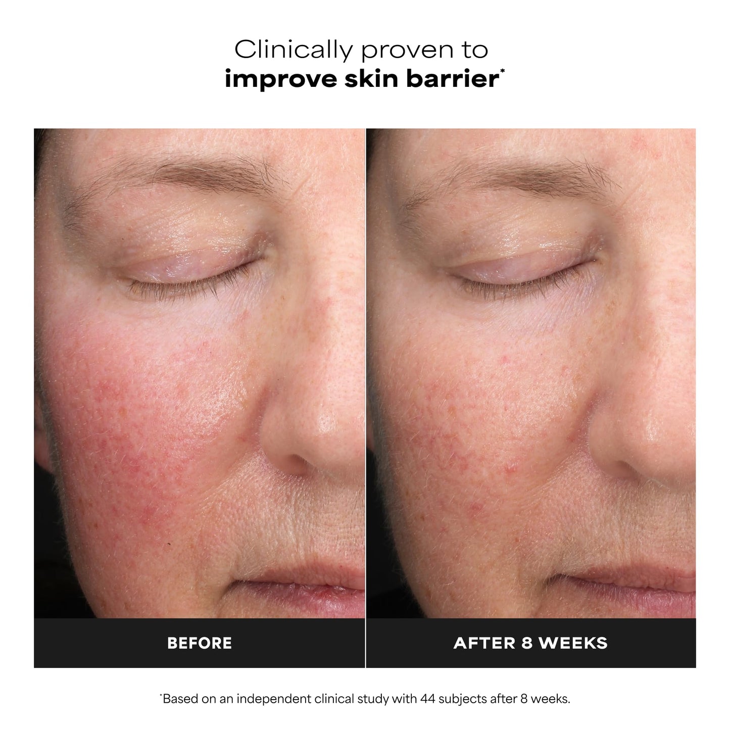 Paula’s Choice Liquid Face Exfoliant 6% Mandelic Acid + 2% Lactic Acid Exfoliant, Gentle Daily AHA Exfoliation for Discoloration, Bumpy Texture & Radiance, for Sensitive Skin, Fragrance-Free, 1 fl oz