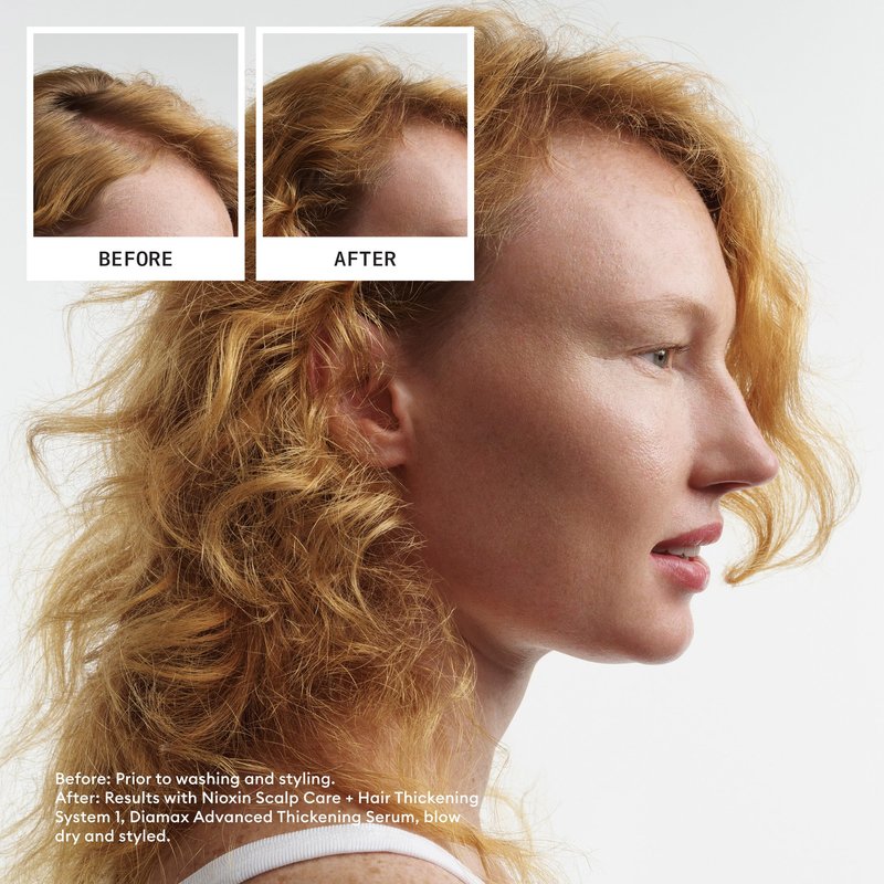 NIOXIN Scalp + Hair Thickening System 1 Leave on Treatment | For Natural or Untreated Hair with Light Thinning | 3.4 Fl oz.