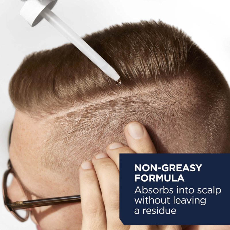 Head & Shoulders Scalp X 5% Minoxidil Hair Regrowth 2x Daily Leave-On Treatment for Men's Thinning Hair & Hair Loss, 3-Month Supply, 2 Fl Oz Each, (Set of 3)