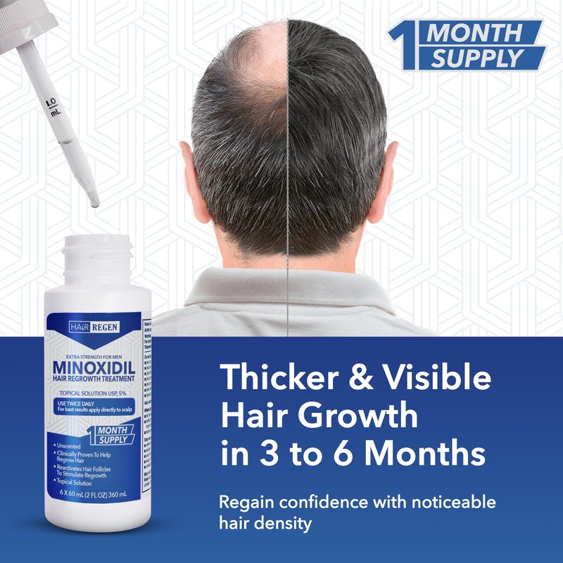 Hair Regen Liquid Minoxidil for Men 5% – Advanced Topical Solution for Regrowth – Growth Treatment for Men Hair Loss 6-Pack as 6-Month Supply Kit