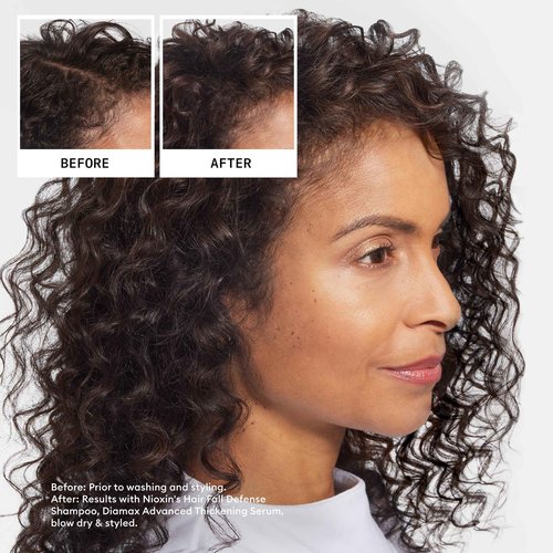 Nioxin Hair Fall Defense Shampoo | Activates Hair Follicles for Visibly Less Hair Loss | 16 Fl Oz + Nioxin Hair Fall Defense Intensive Daily Leave-In Hair Treatment | 2.3 Fl oz.